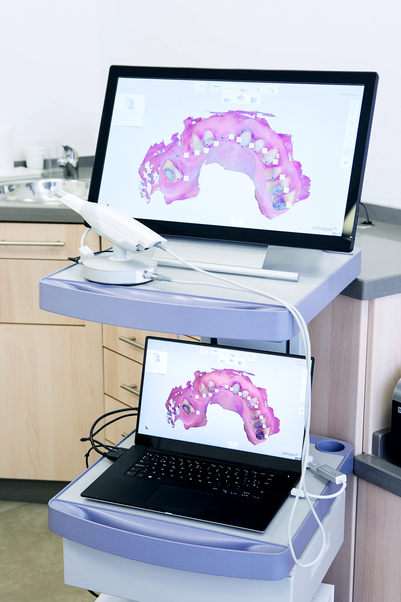 Bone grafting Beaverton - prepare jaw for dental implants