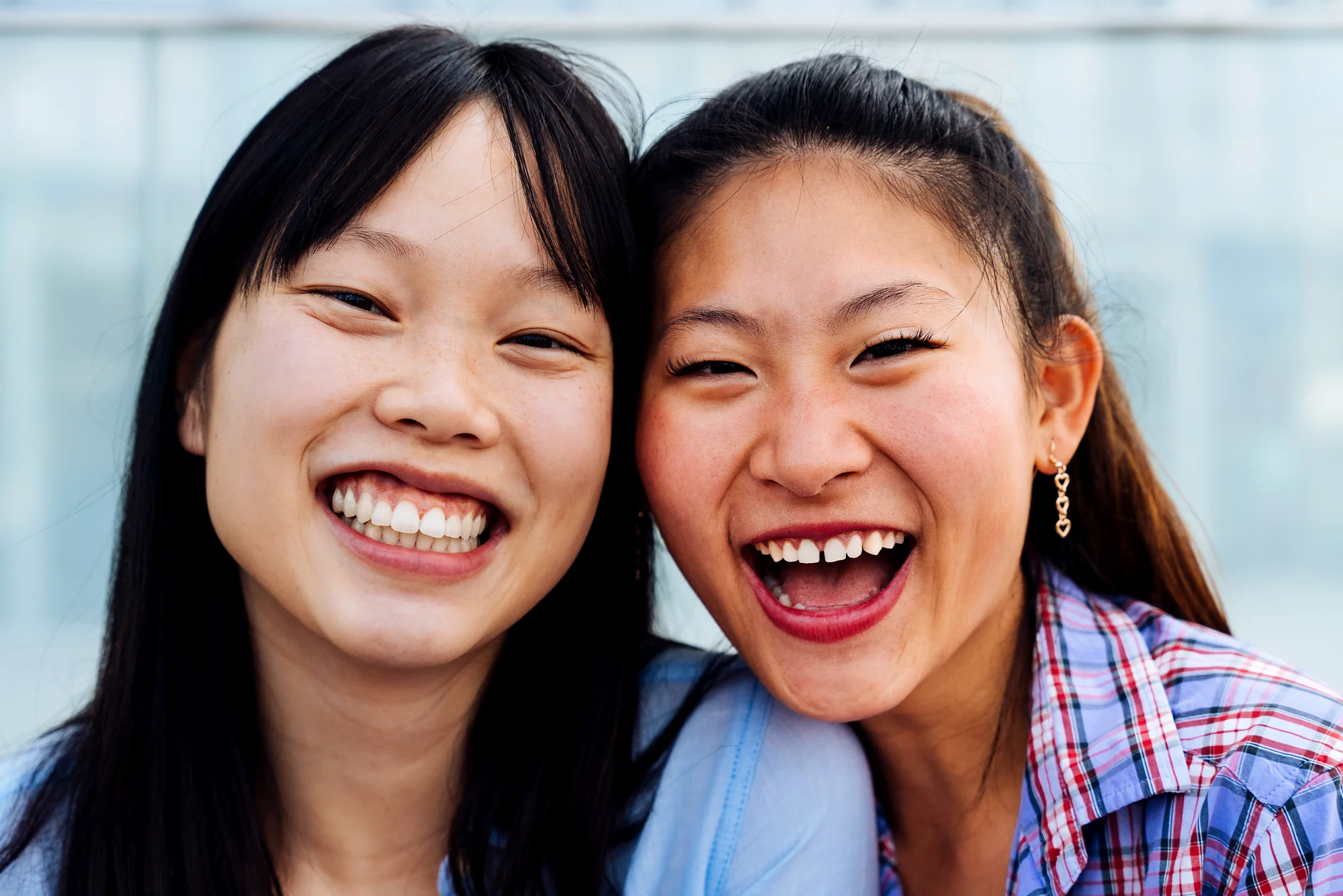 All-on-4 dental implants Beaverton - full arch smile restoration results