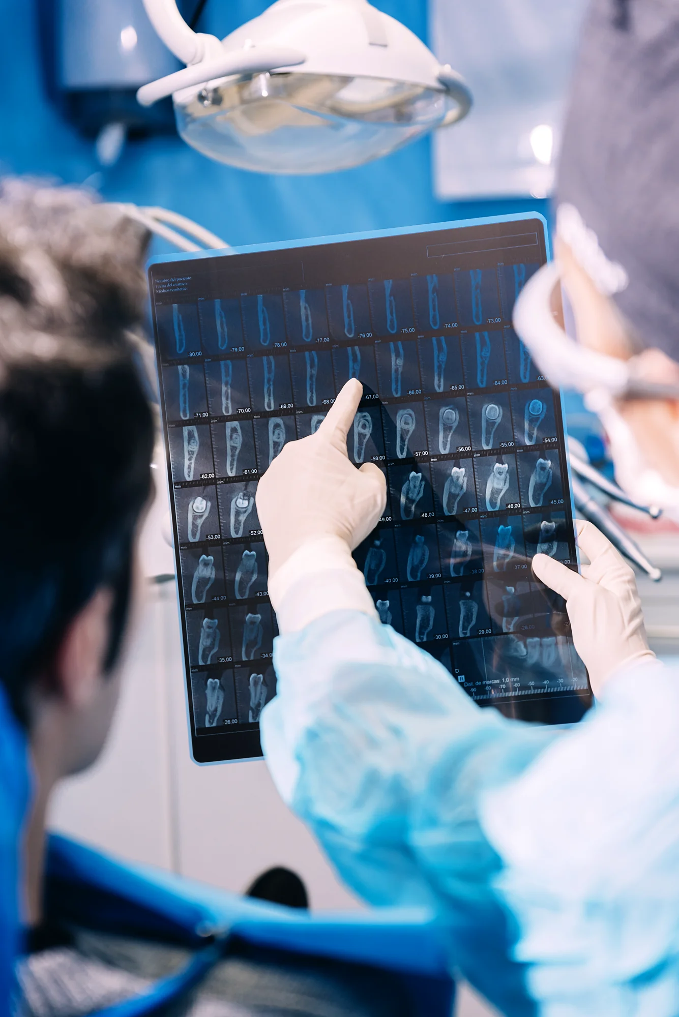 Sinus lift surgery Beaverton - prepare upper jaw for implants